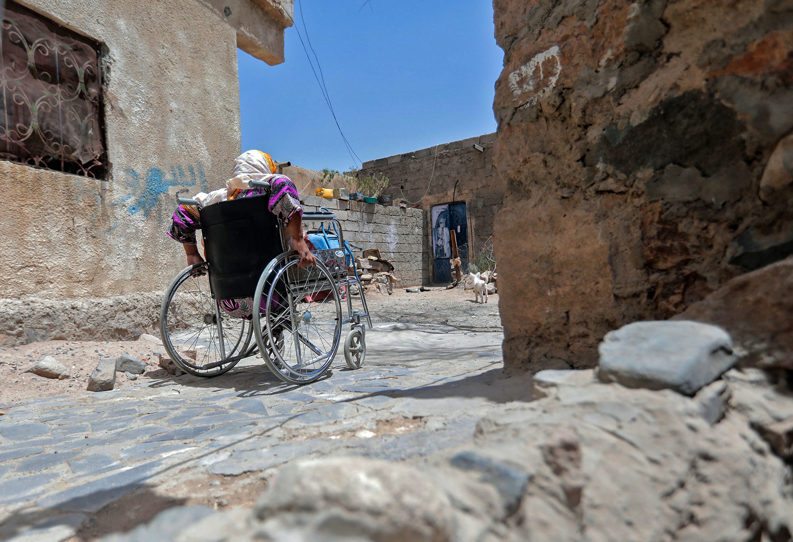 How Yemen’s war-wounded suffered unnecessary amputations
